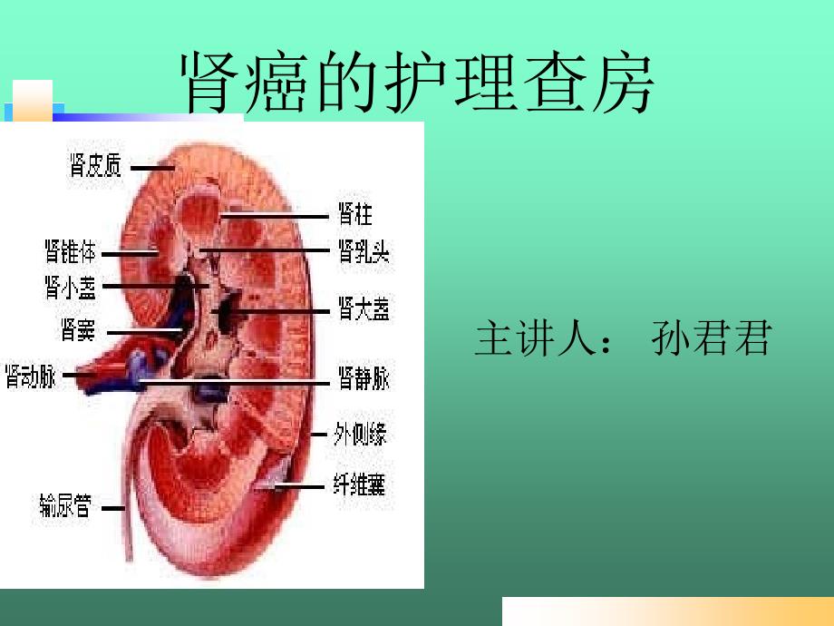 肾癌护理查房_第1页