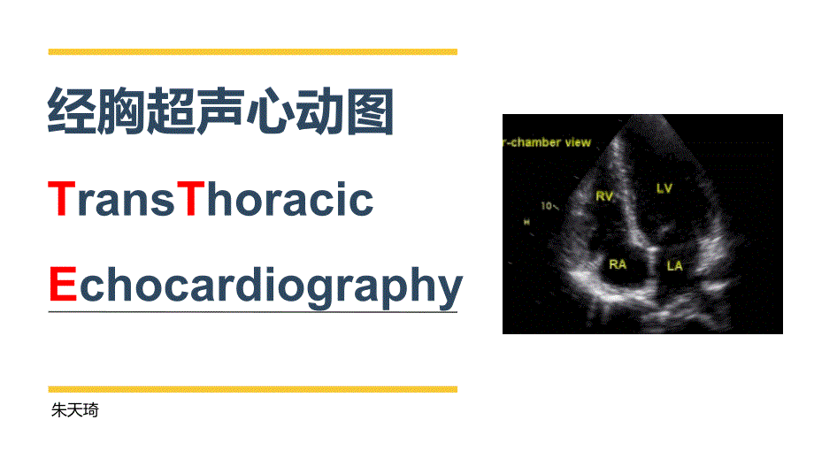 经胸超声心动图_第1页