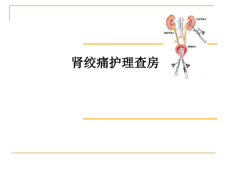 肾绞痛护理查房1_第1页