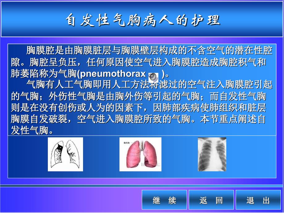 自发性气胸病人护理PPT课件_第1页