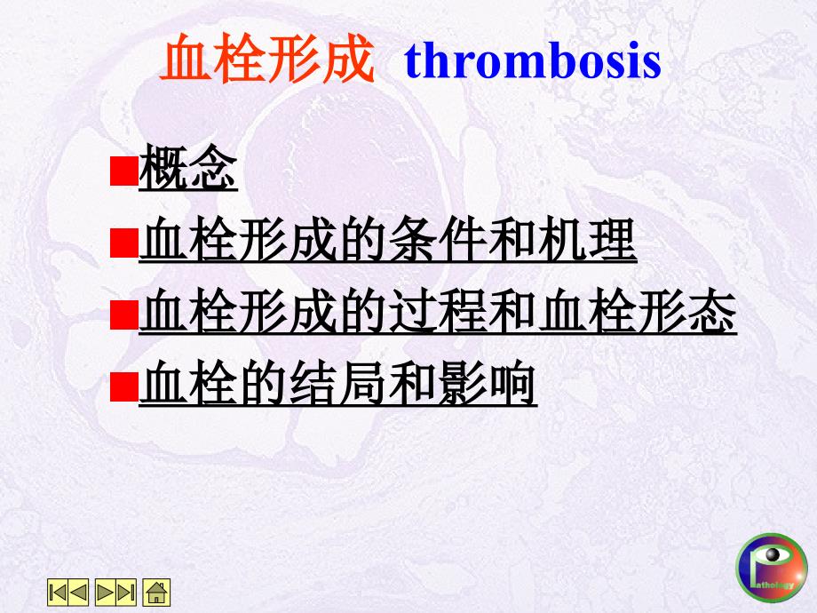 血栓形成原理阐述_第1页