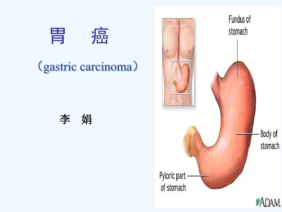 胃癌教学课件_第1页