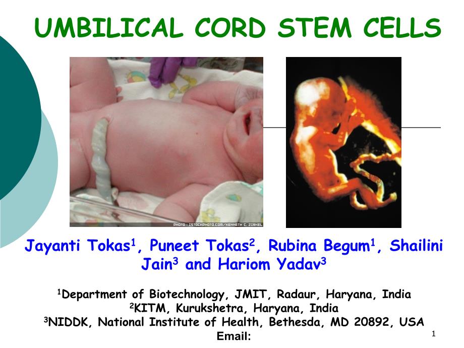 脐带间充质干细胞最新进展_第1页