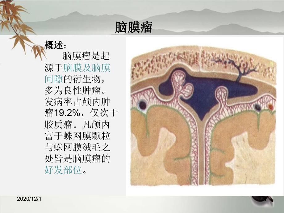 脑膜瘤护理查房_第1页