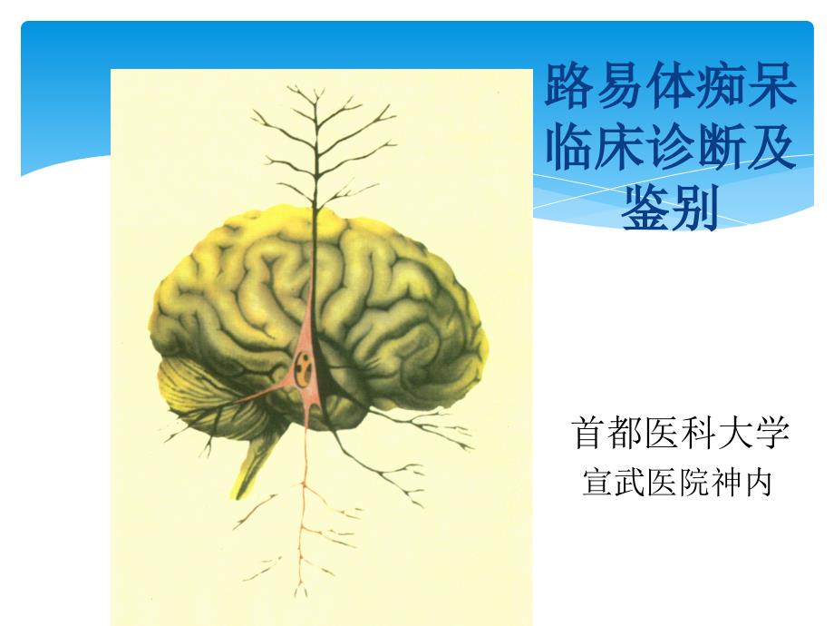 路易体痴呆临床诊断与鉴别PPT_第1页