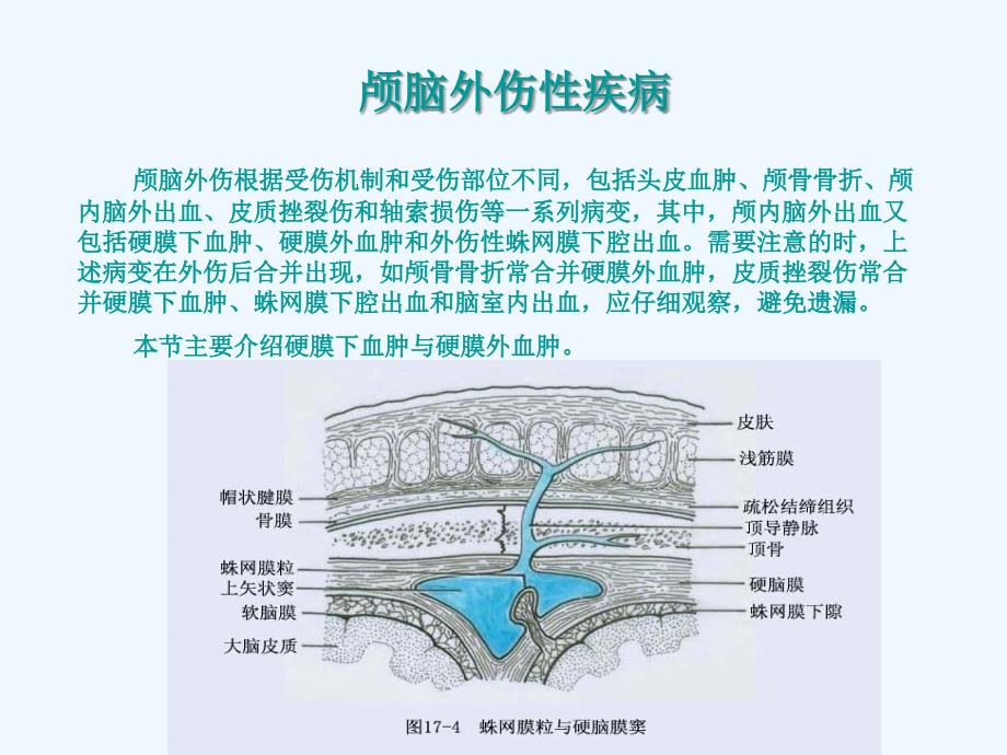 颅脑外伤性疾病_第1页