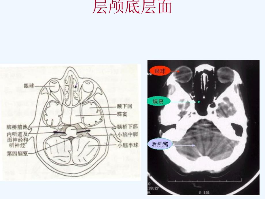 颅脑基本病变CT诊断_第1页