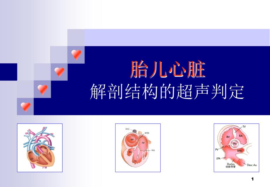 胎儿心脏解剖结构的超声判定_第1页