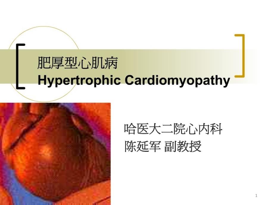 肥厚型心肌病课件_第1页