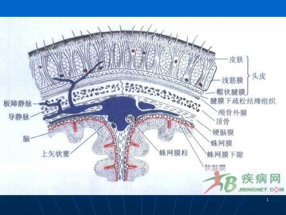 硬膜外血肿清除术课件_第1页