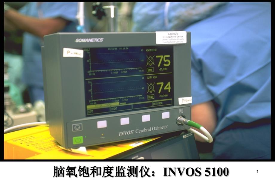 脑氧监测仪医学课件_第1页