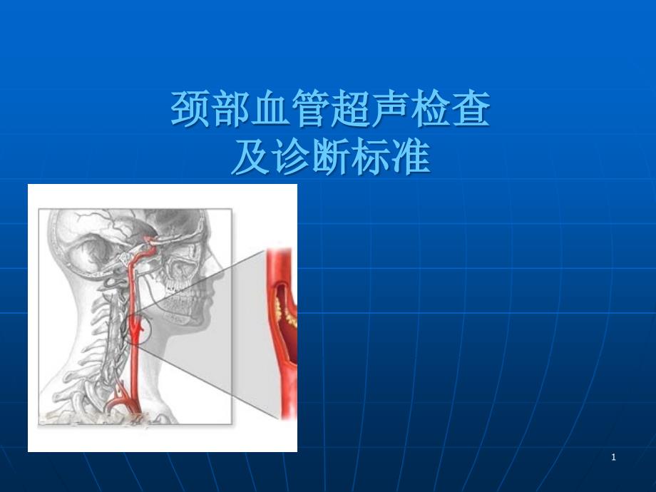 颈部血管超声检查及诊断标准课件_第1页