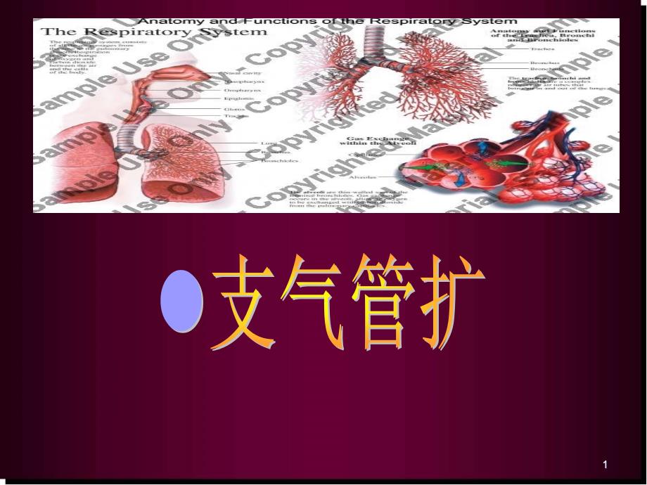 支气管扩张症护理查房医学课件_第1页