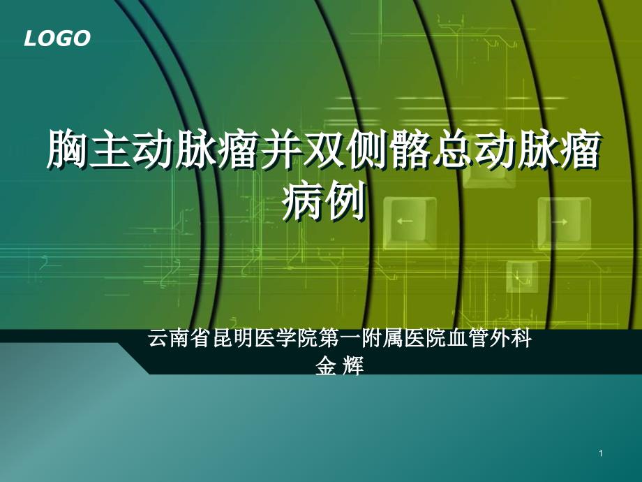 胸主动脉瘤并双侧髂总动脉瘤病例课件_第1页