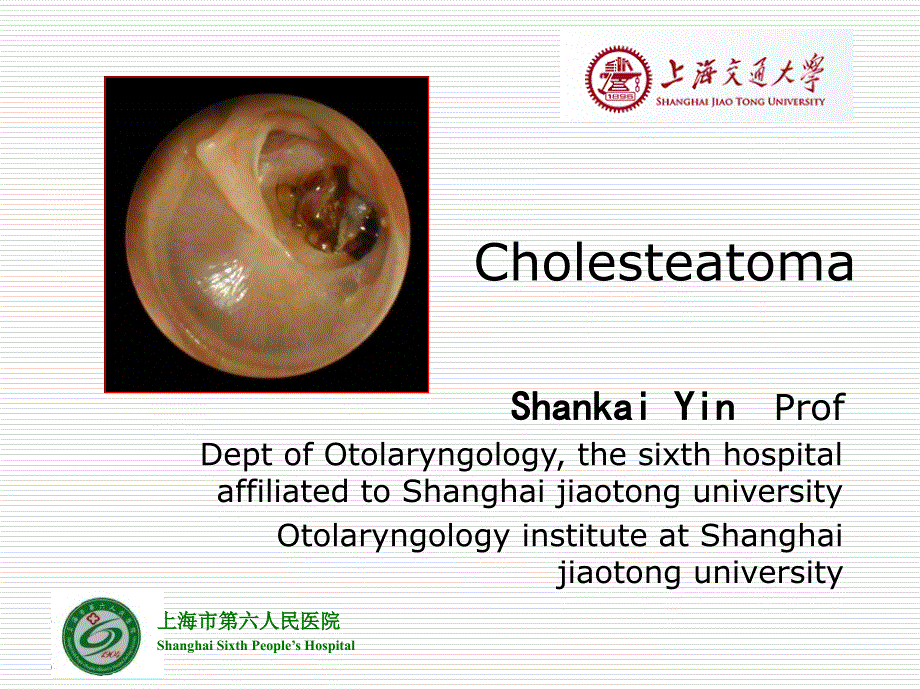 上海交通大学耳鼻咽喉科学英文版课件 cholesteatoma_第1页