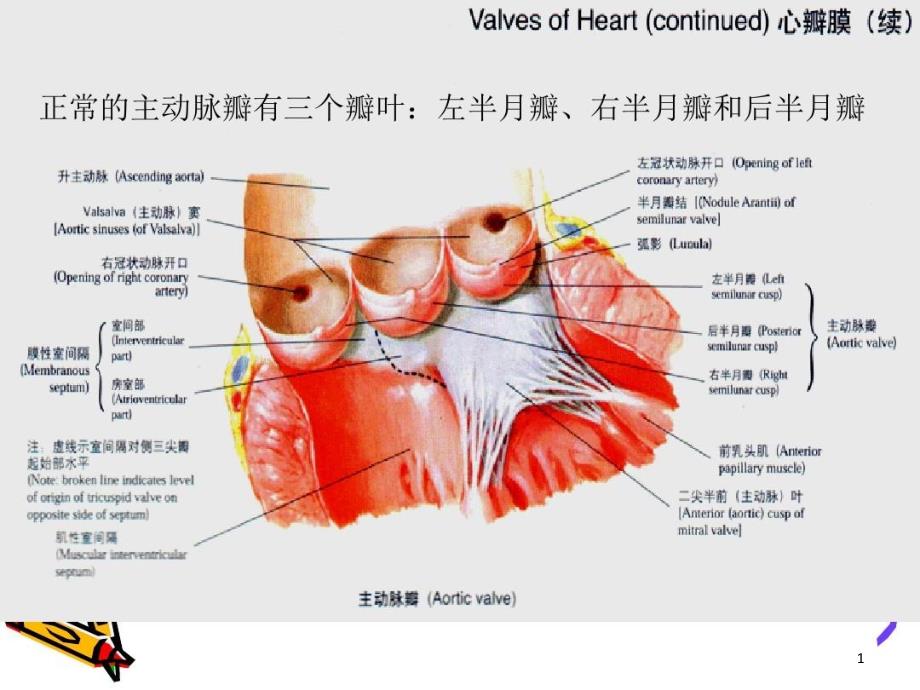 主动脉狭窄护理课件_第1页