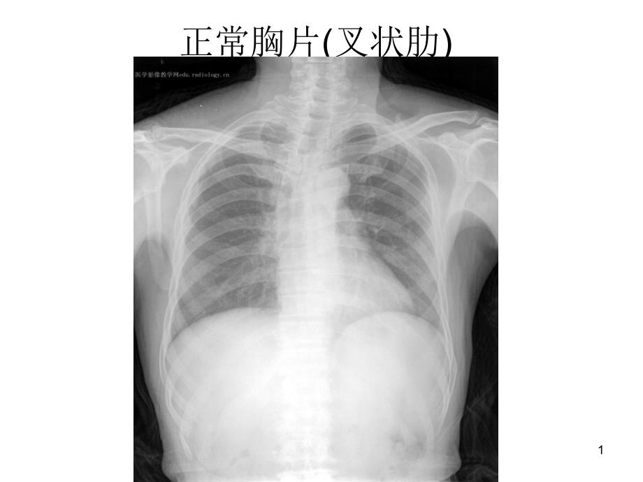 影像诊断图片示例课件_第1页