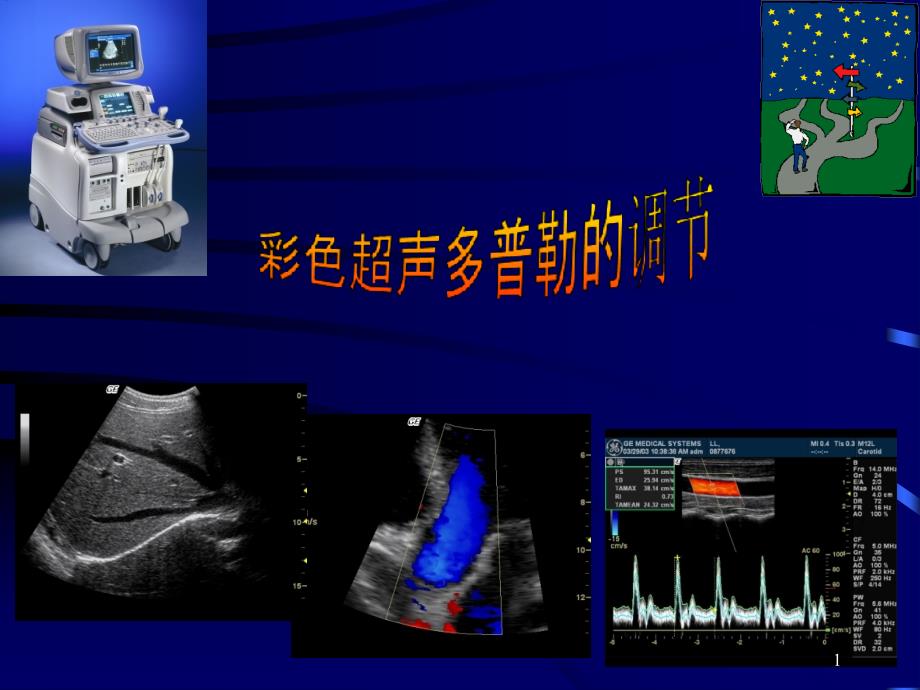 彩色超声诊断仪及彩色超声多普勒的临床应用课件_第1页