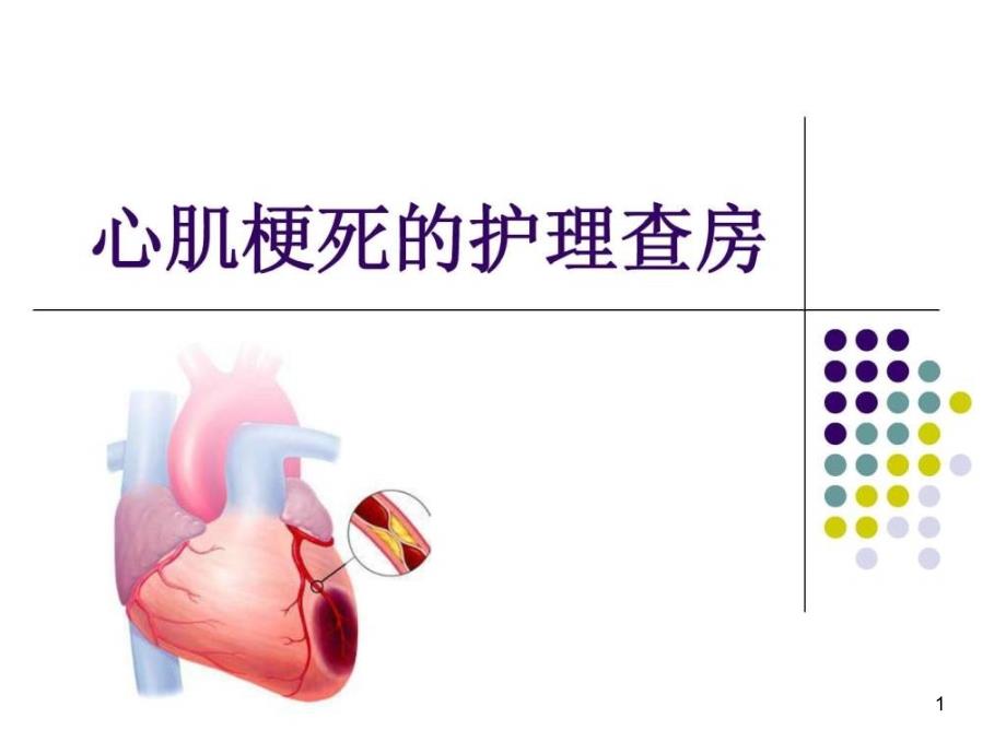 心肌梗死护理查房30张课件_第1页