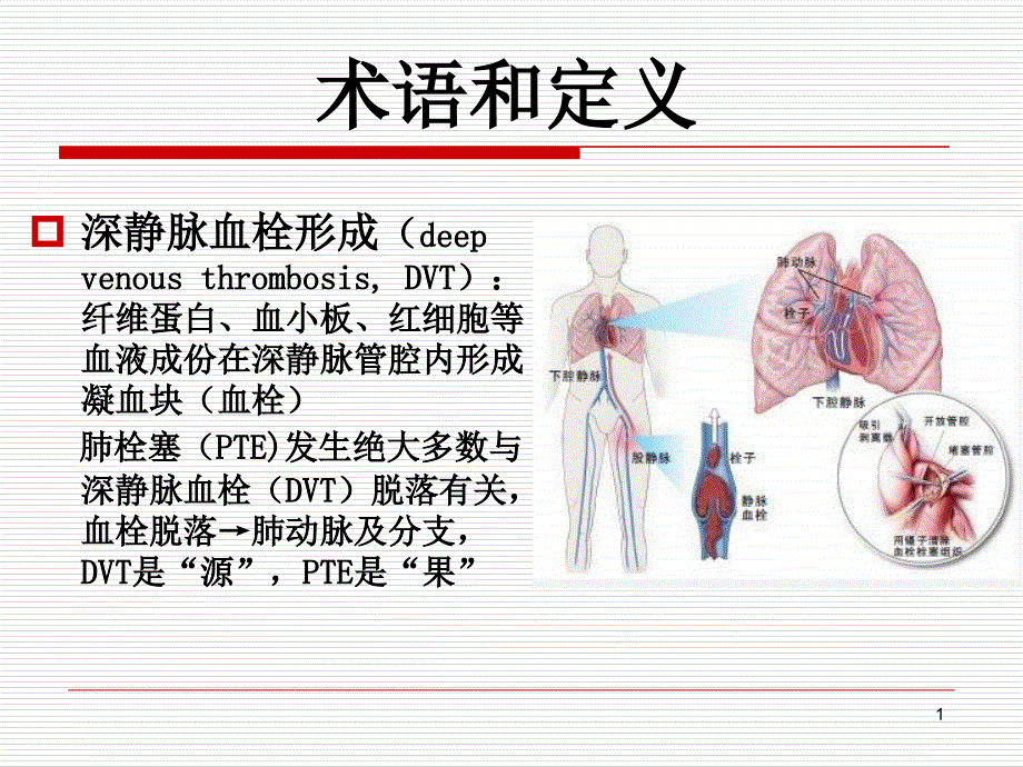 康复患者下肢静脉血栓防治课件_第1页