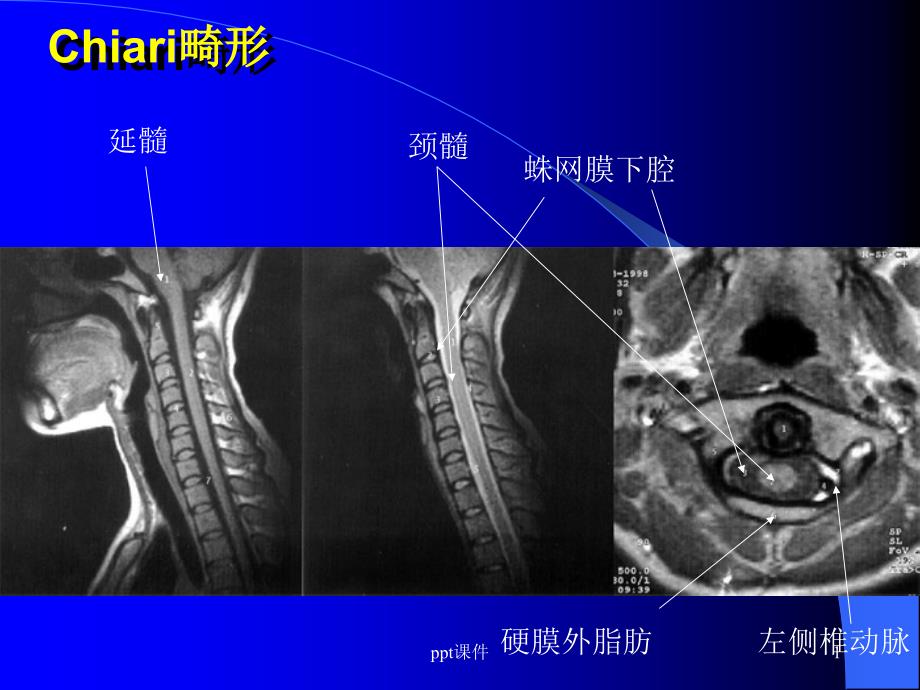 脑部MRI图像--课件_第1页