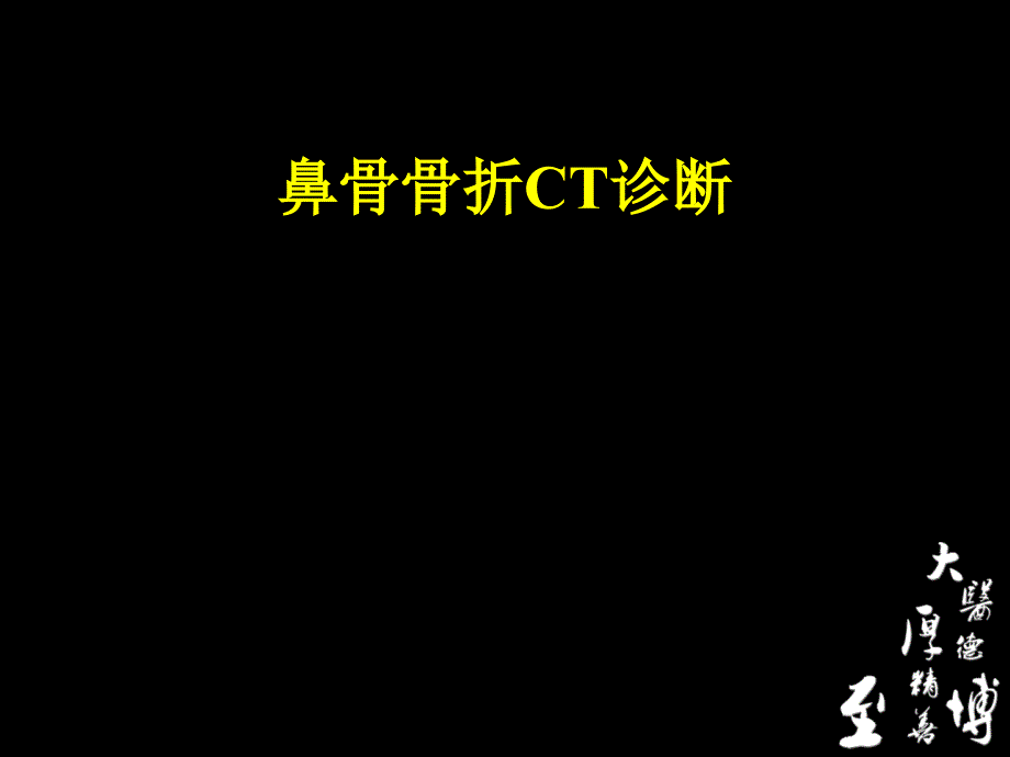 鼻骨骨折CT诊断课件_第1页