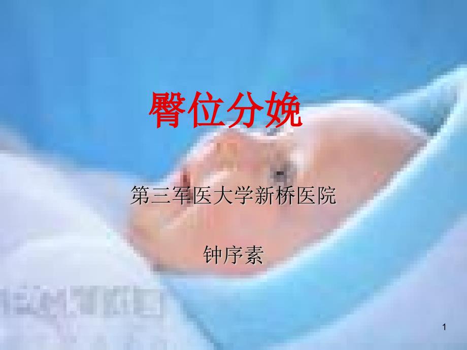 臀位分娩完整版课件_第1页