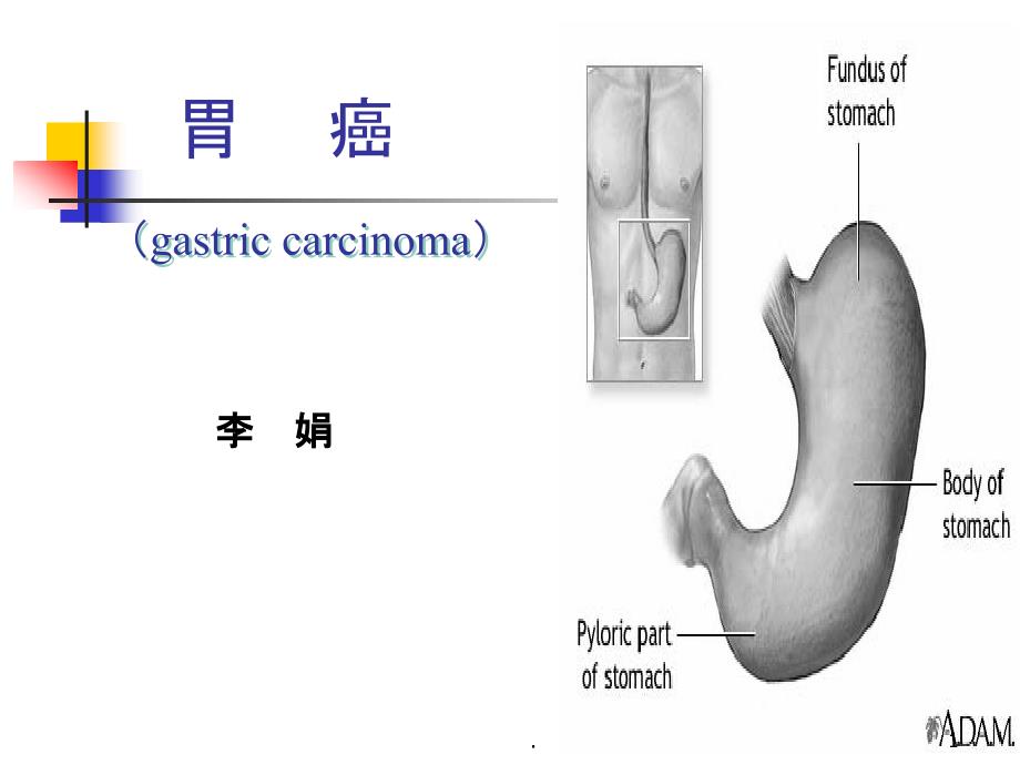 胃癌教学完整课件_第1页