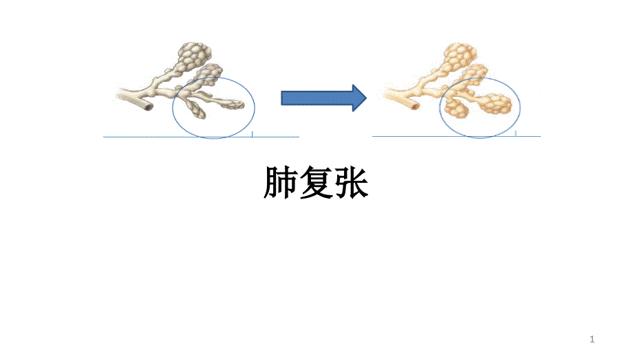 肺复张优质课件_第1页