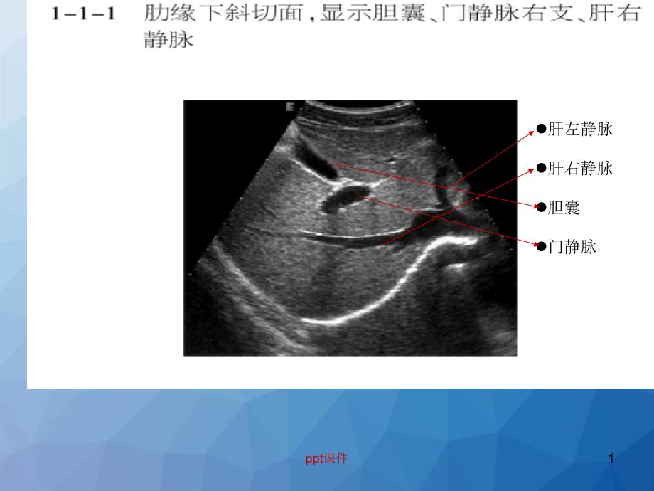 肝胆超声解剖--课件_第1页