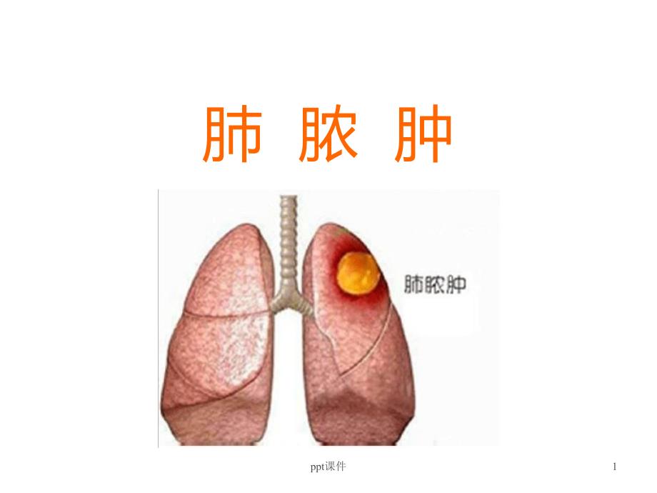 肺脓肿病人的护理--课件_第1页