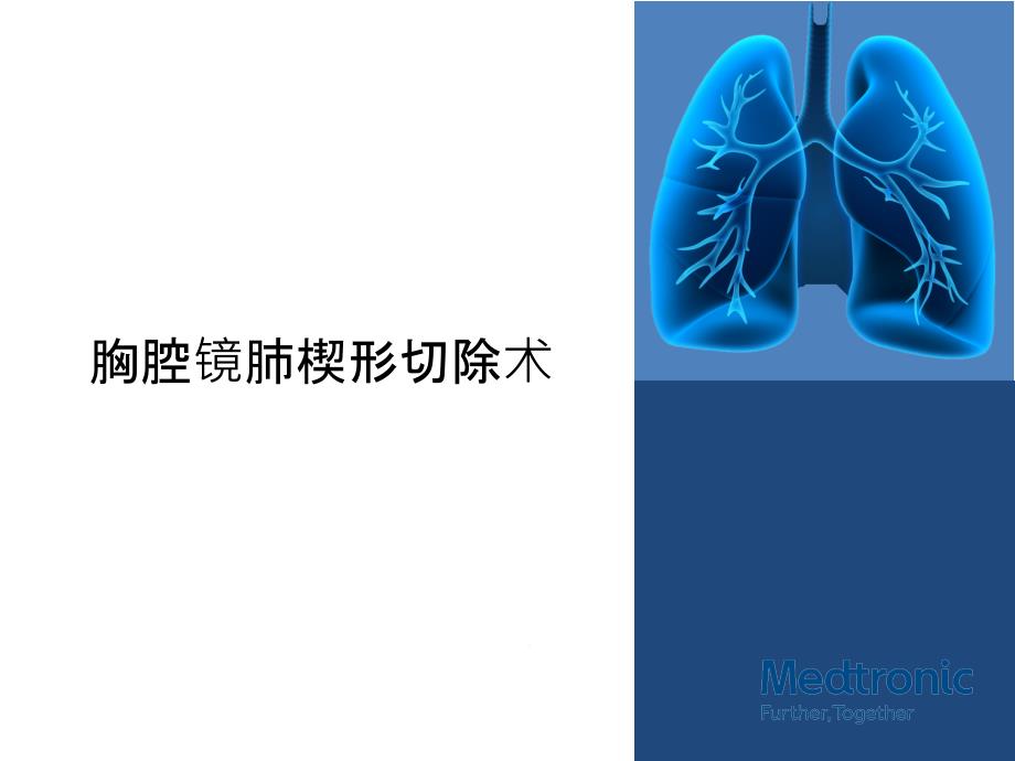 胸腔镜肺楔形切除术课件_第1页