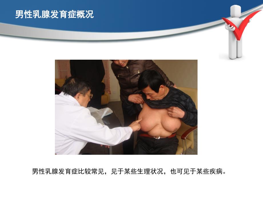 男性乳房发育_第1页