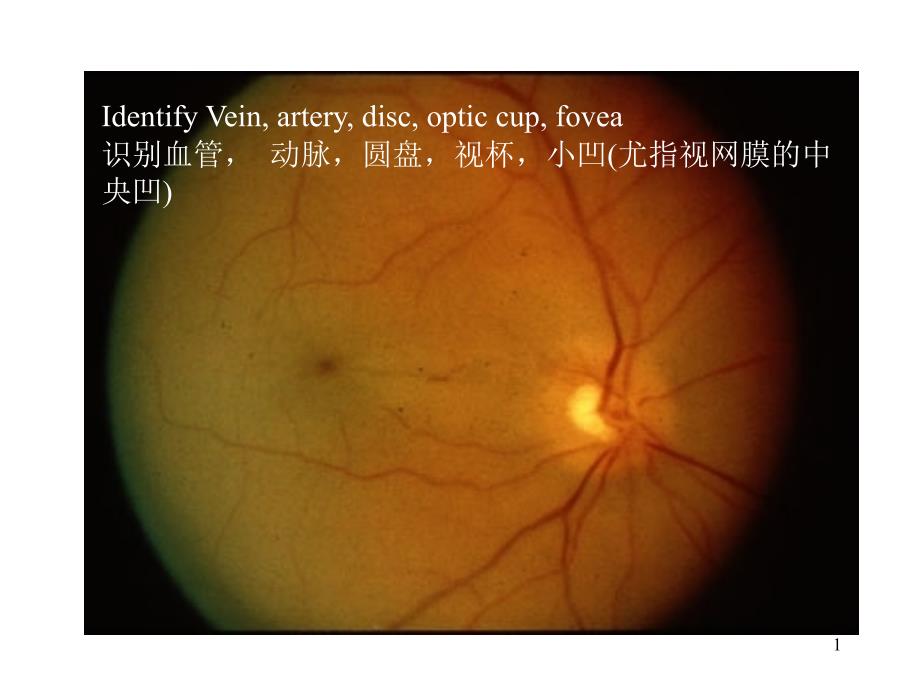 眼科常见结构及英文课件_第1页