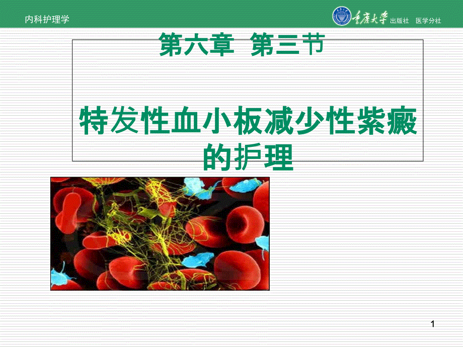 内科护理学第六章第三节特发性血小板减少性紫癜的护理-课件_第1页