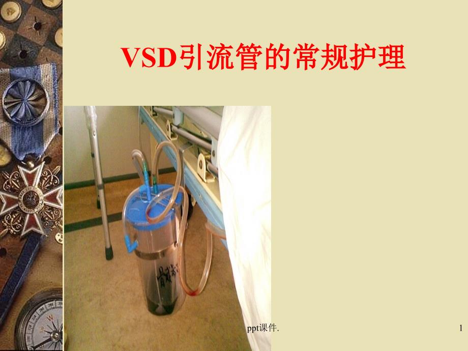 VSD引流管的常规护理课件_第1页