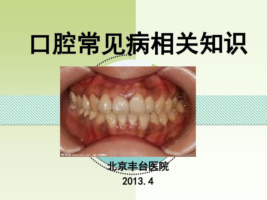 口腔常见病相关知识课件_第1页