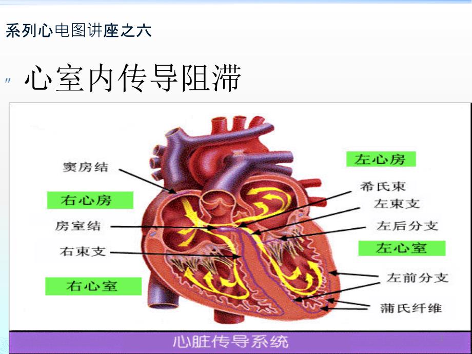 心室内传导阻滞ppt课件_第1页