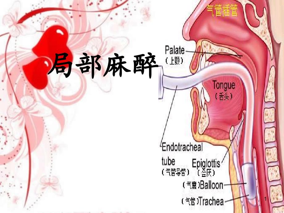 局部麻醉护理ppt课件_第1页