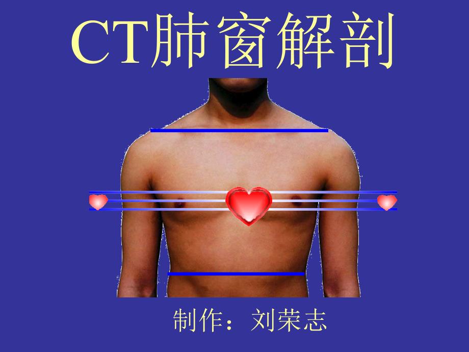 CT肺窗横断层解剖讲解ppt课件_第1页