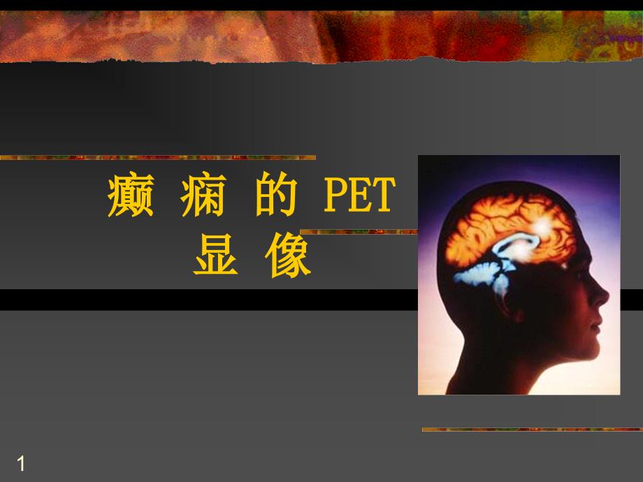 癫痫的PET显像ppt课件_第1页