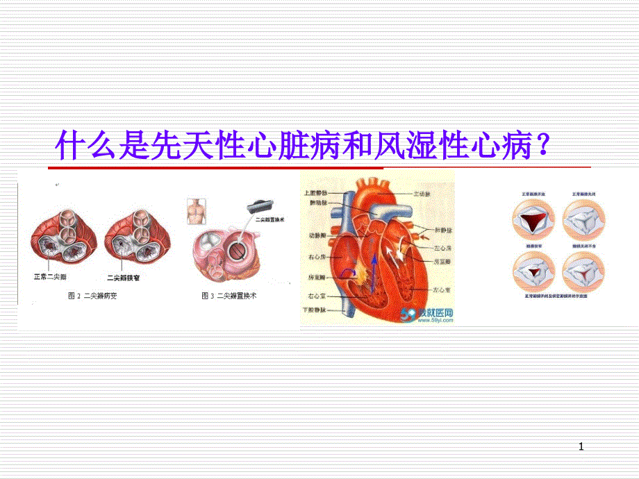 先天性心脏及风湿性心脏病【生物作业】ppt课件_第1页