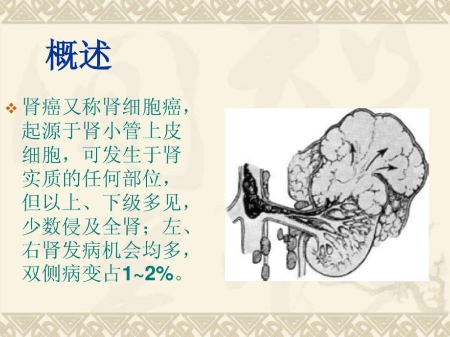 腎癌的治療與護理指南_第1頁