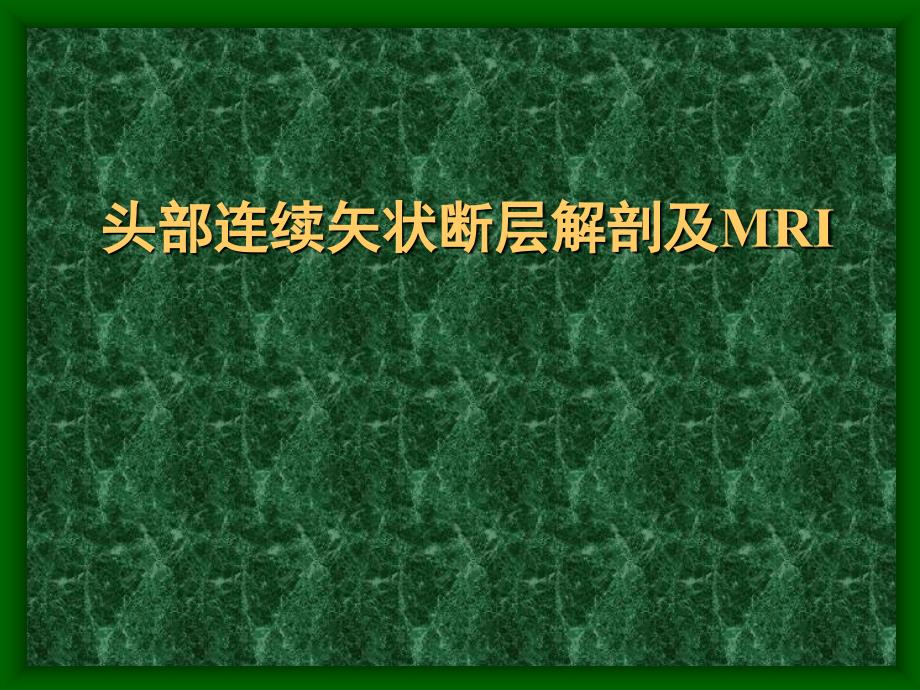 头部连续矢状断层解剖及MRI名师编辑PPT课件_第1页