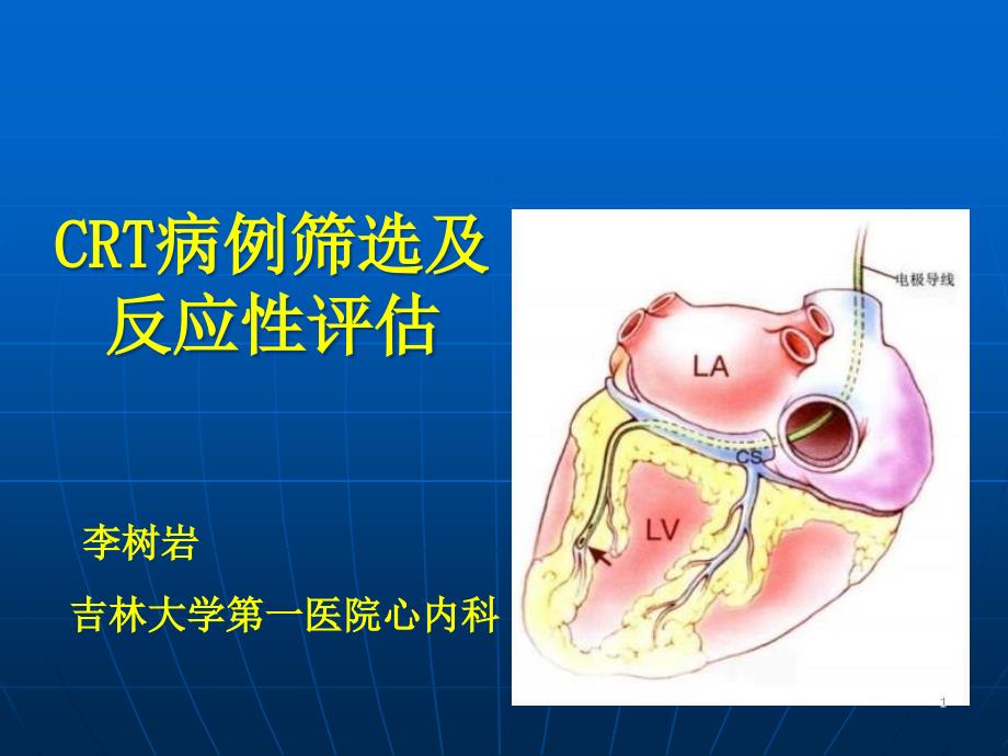 CRT病例筛选及反应性评估课件_第1页