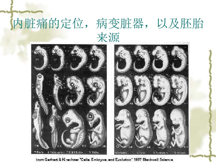 内脏痛的定位与胚胎起源课件_第1页