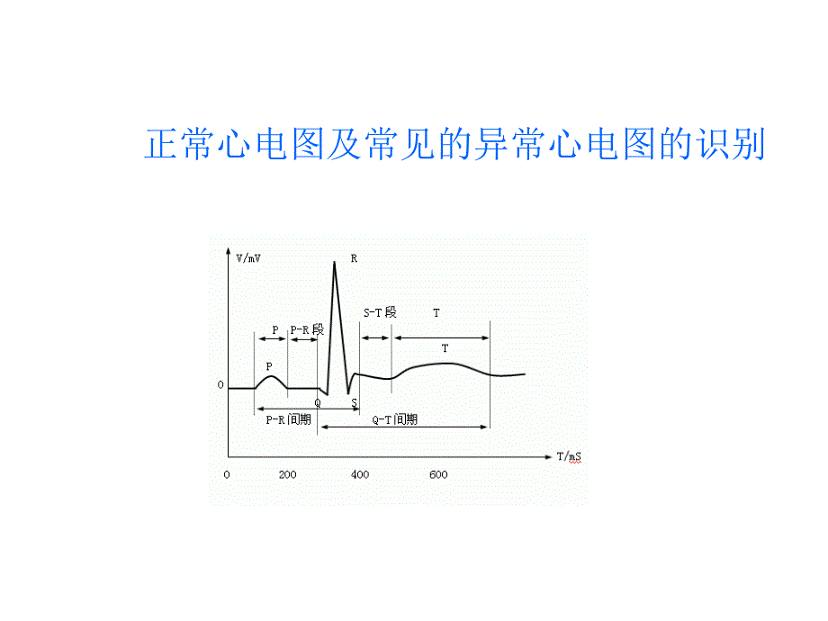 正常心电图及常见的异常心电图的识别_第1页