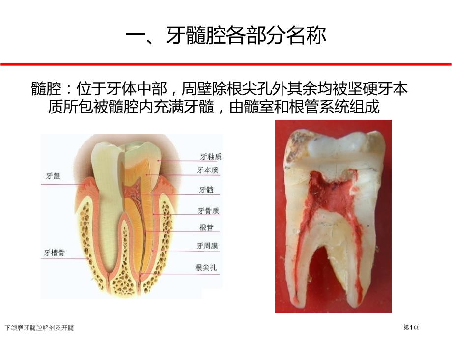 下颌磨牙髓腔解剖及开髓_第1页