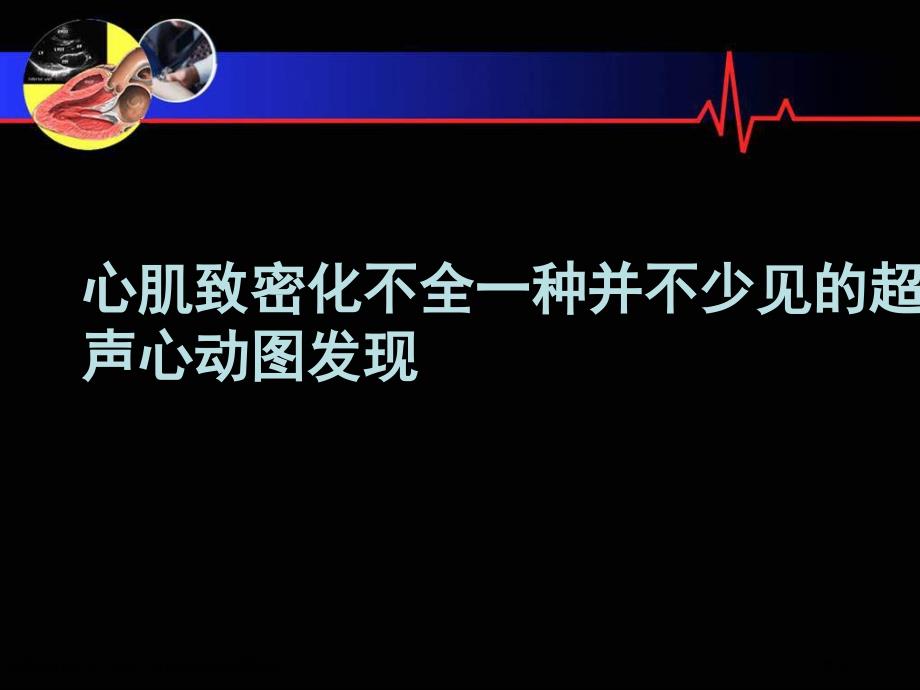 心肌致密化不全一种并不少见的超声心动图发现_第1页