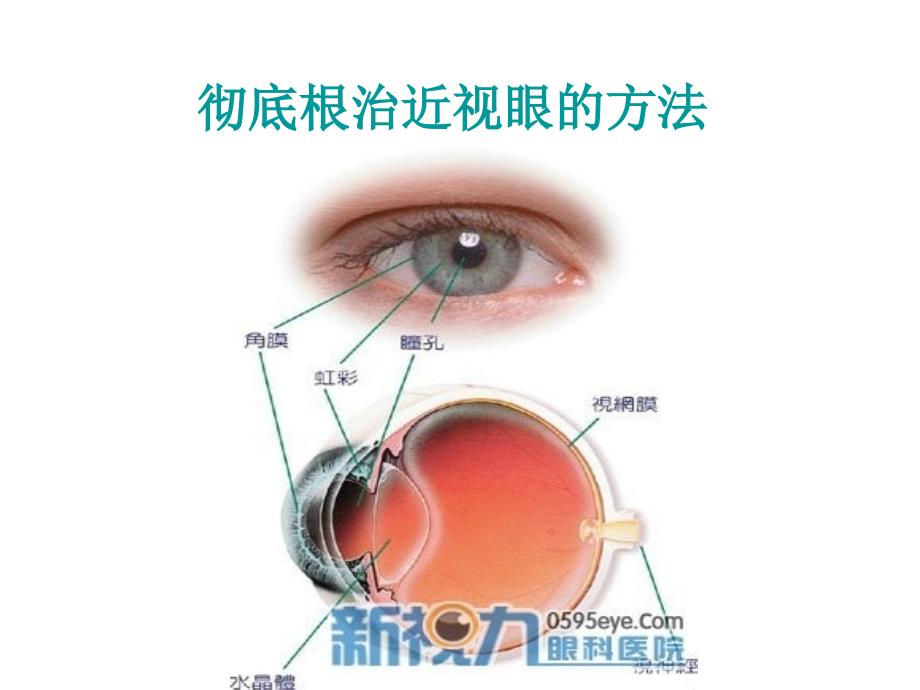 彻底根治近视眼[必看经典珍藏版]_第1页